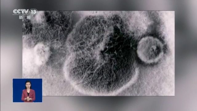 女孩脑部被真菌侵蚀出现“空洞”？大扫除要警惕霉变粉尘！(图1)