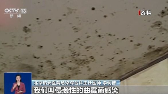 女孩脑部被真菌侵蚀出现“空洞”？大扫除要警惕霉变粉尘！(图3)