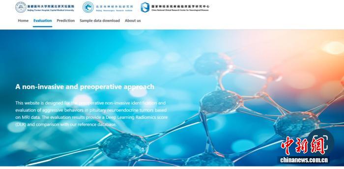 助力垂体腺瘤评估识别 中国团队研发出深度学习模型(图2)