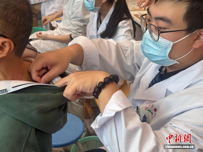 “冬病冬治”正当时：广州多家医院“开贴”岭南“三九天灸”(图1)