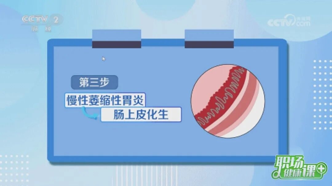 感染“幽门螺杆菌”到“胃癌”，只有5步！(图3)