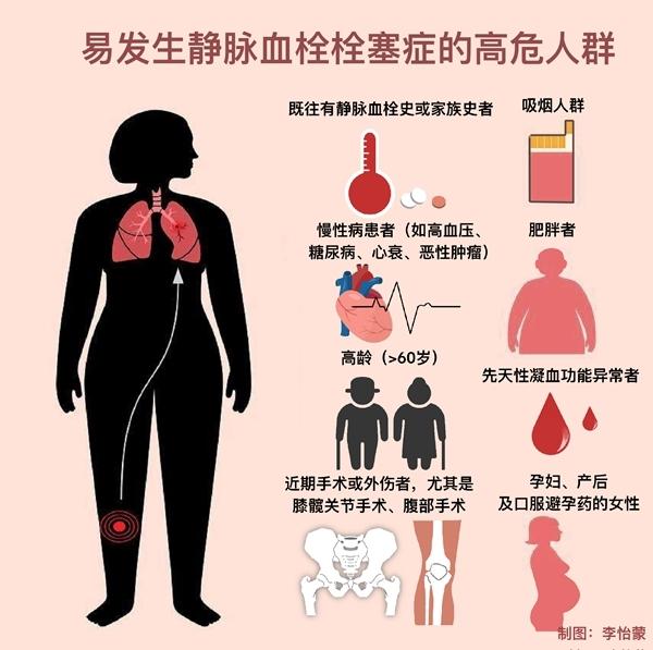 春运长时间乘车乘机,这些防血栓知识请记好(图1) 春运长时间乘车乘机,这些防血栓知识请记好(图1)
