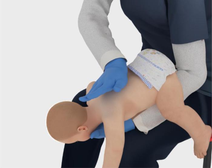 噎住窒息怎么办?别光“顶肚子” 新急救步骤速学(图4) 噎住窒息怎么办?别光“顶肚子” 新急救步骤速学(图4)