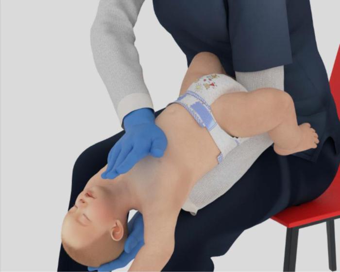 噎住窒息怎么办?别光“顶肚子” 新急救步骤速学(图5) 噎住窒息怎么办?别光“顶肚子” 新急救步骤速学(图5)