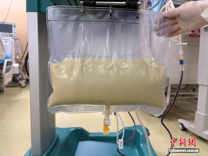 湖南双胎孕妇“牛奶血”诱发多重危情 多学