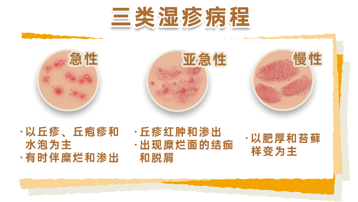 湿疹可能是“干”出来的 冬季皮肤瘙痒需警惕(图1)
