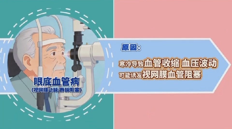 冬季眼睛“闹别扭”？这些问题要警惕(图4)