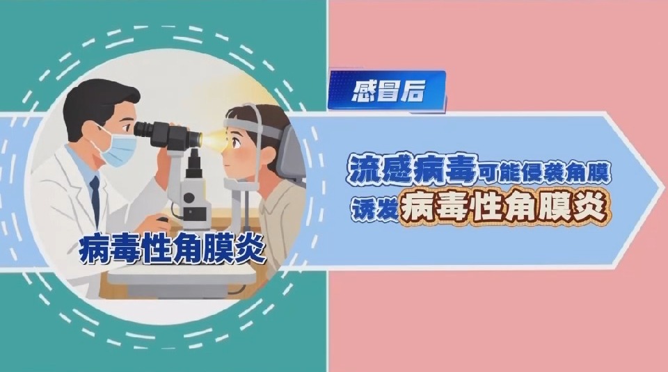 冬季眼睛“闹别扭”？这些问题要警惕(图2)