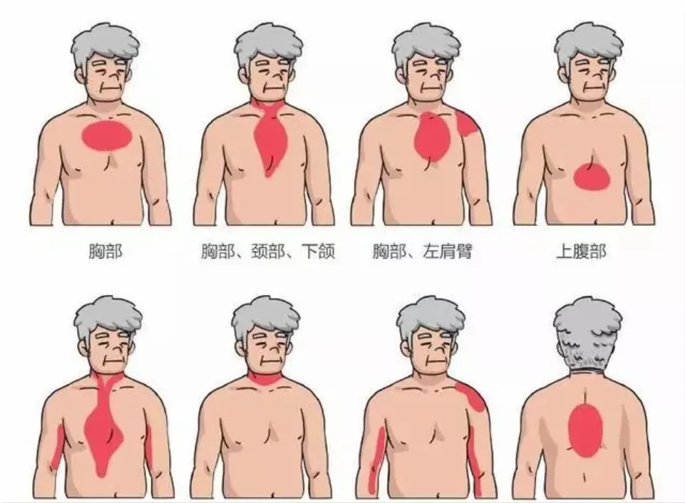 为什么猝死会盯上看似强壮的年轻人？怎么办