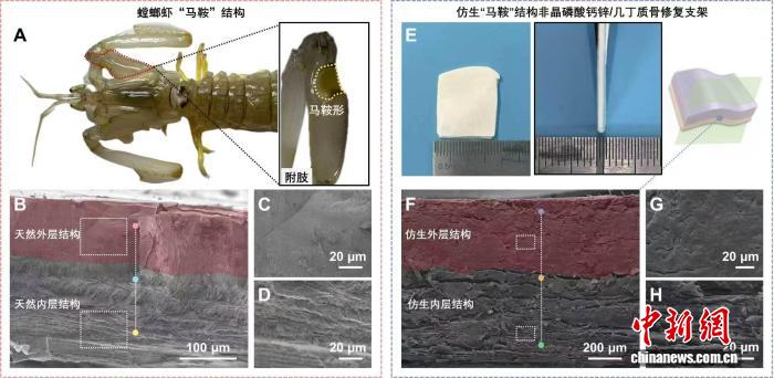 中国生物活性骨修复材料获系列突破 三项创